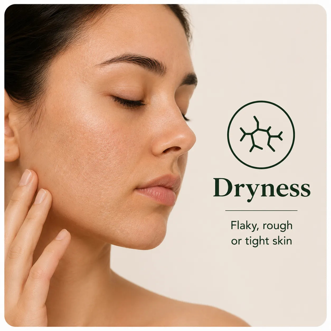 Dryness