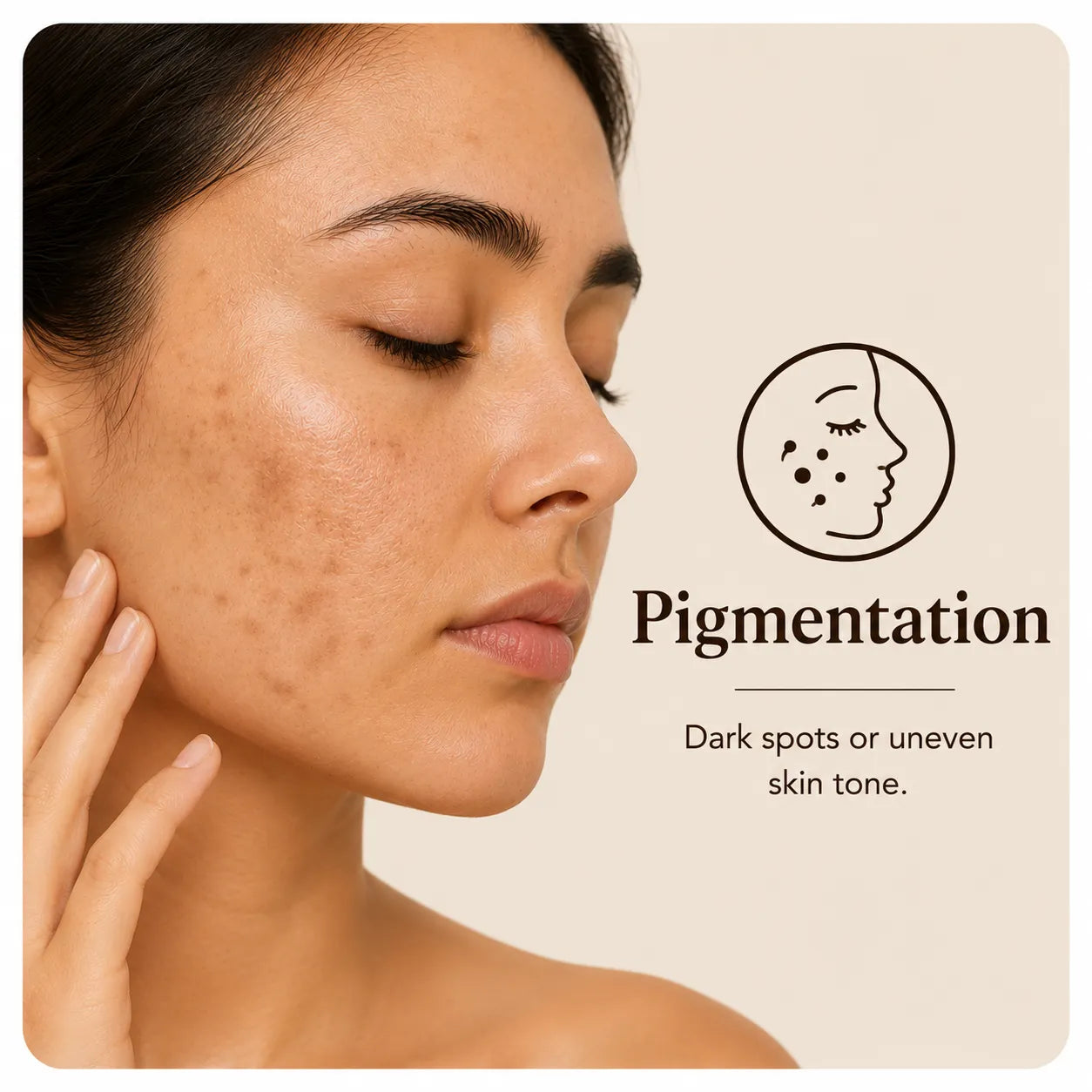 Pigmentation