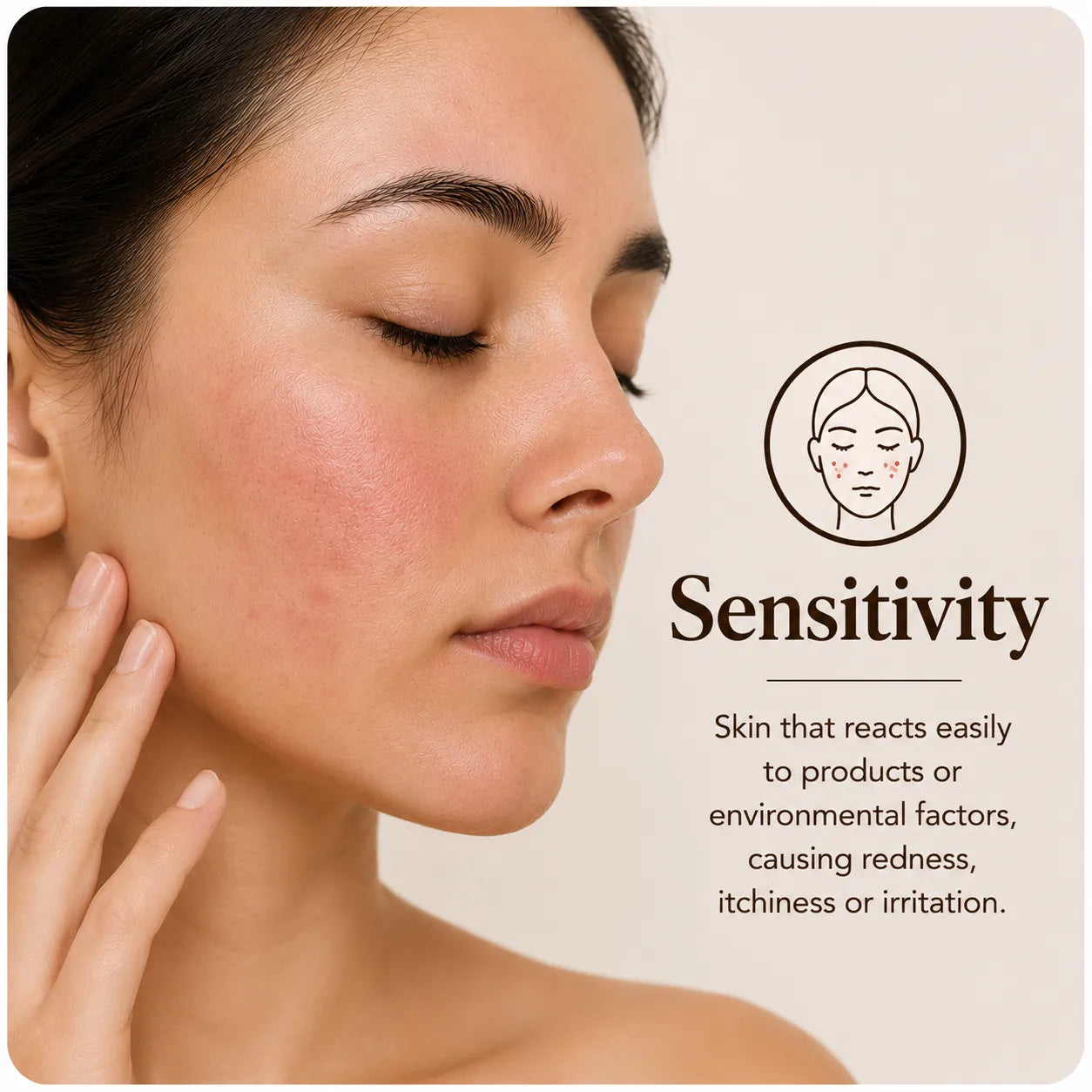 Sensitivity